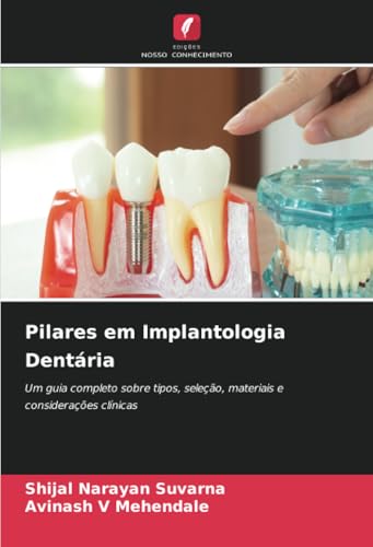 Pilares em Implantologia Dentária: Um guia completo sobre tipos, seleção, materiais e considerações clínicas von Edições Nosso Conhecimento