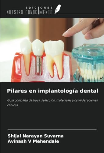 Pilares en implantología dental: Guía completa de tipos, selección, materiales y consideraciones clínicas von Ediciones Nuestro Conocimiento