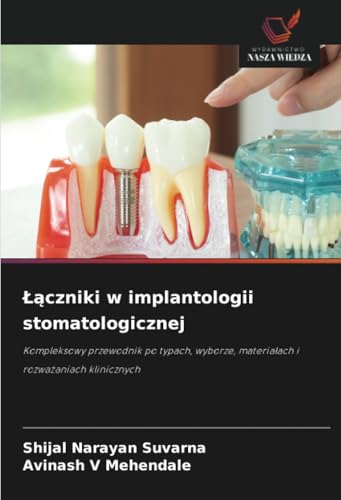 Łączniki w implantologii stomatologicznej: Kompleksowy przewodnik po typach, wyborze, materiałach i rozważaniach klinicznych: Kompleksowy przewodnik ... materia¿ach i rozwa¿aniach klinicznych von Wydawnictwo Nasza Wiedza