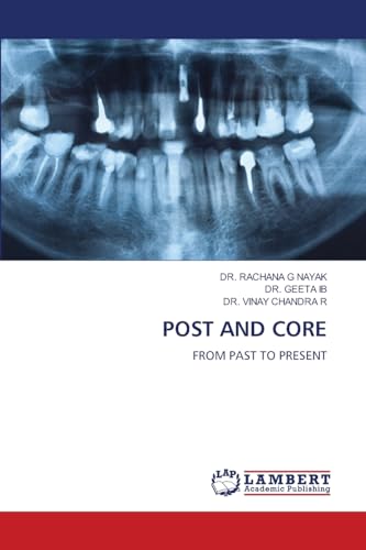 POST AND CORE: FROM PAST TO PRESENT von LAP LAMBERT Academic Publishing