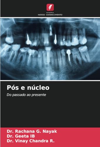 Pós e núcleo: Do passado ao presente von Edições Nosso Conhecimento