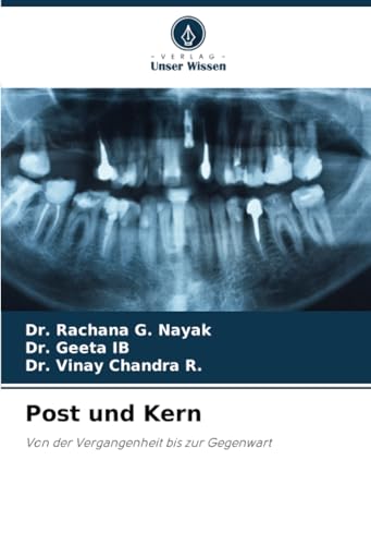 Post und Kern: Von der Vergangenheit bis zur Gegenwart
