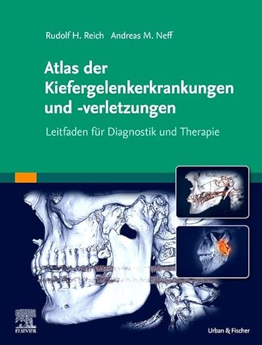 Atlas der Kiefergelenkerkrankungen und -verletzungen: Leitfaden für Diagnostik und Therapie von Urban & Fischer Verlag/Elsevier GmbH