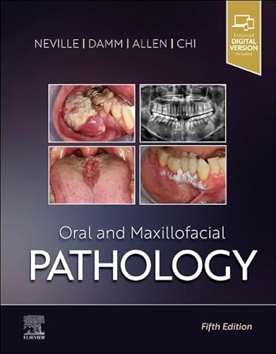Oral and Maxillofacial Pathology von Elsevier