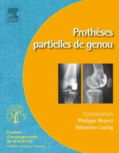 Prothèses partielles de genou von Elsevier Masson