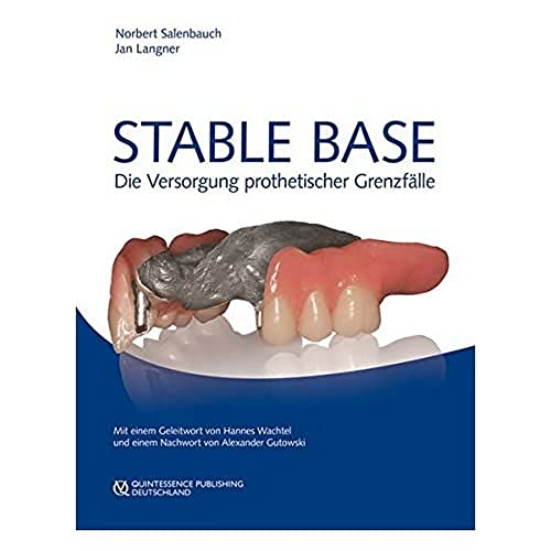 Stable Base: Die Versorgung prothetischer Grenzfälle