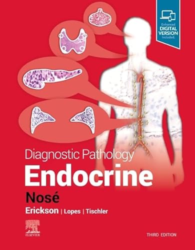 Diagnostic Pathology: Endocrine von Elsevier