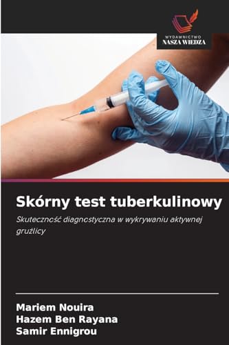 Skórny test tuberkulinowy: Skuteczno¿¿ diagnostyczna w wykrywaniu aktywnej gru¿licy Skórny test tuberkulinowy: Skuteczno¿¿ diagnostyczna w wykrywaniu aktywnej gru¿licy von Wydawnictwo Nasza Wiedza