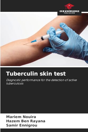 Tuberculin skin test: Diagnostic performance for the detection of active tuberculosis Tuberculin skin test: Diagnostic performance for the detection of active tuberculosis von Our Knowledge Publishing