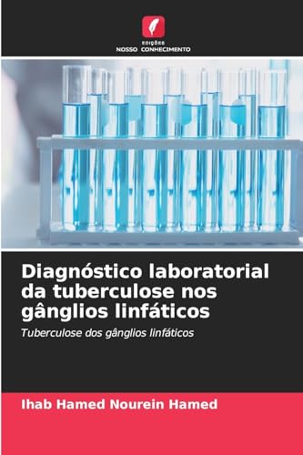 Diagnóstico laboratorial da tuberculose nos gânglios linfáticos: Tuberculose dos gânglios linfáticos von Edições Nosso Conhecimento