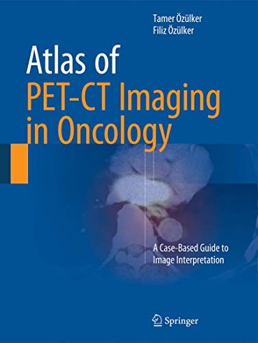 Atlas of PET-CT Imaging in Oncology: A Case-Based Guide to Image Interpretation Atlas of PET-CT Imaging in Oncology: A Case-Based Guide to Image Interpretation von Springer