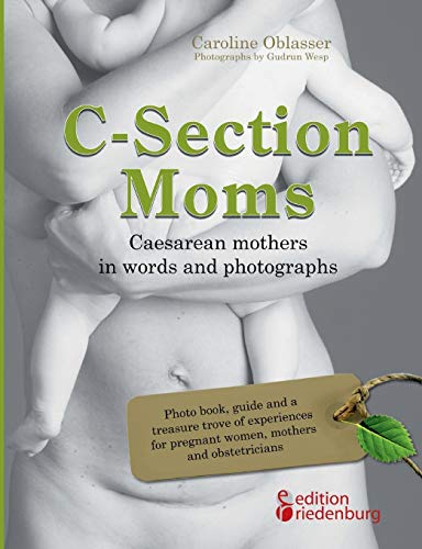 C-Section Moms - Caesarean mothers in words and photographs: Photo book, guide and a treasure trove of experiences for pregnant women, mothers and obstetricians