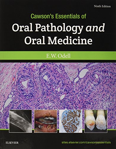 Cawson's Essentials of Oral Pathology and Oral Medicine von Elsevier