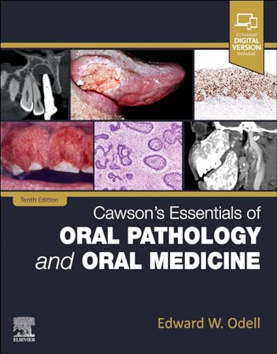 Cawson's Essentials of Oral Pathology and Oral Medicine von Elsevier