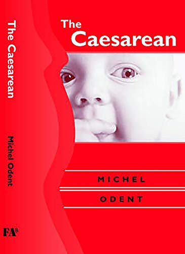 Caesarean von Free Association Books