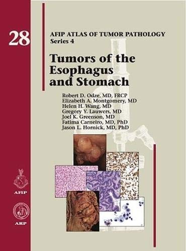 Tumors of the Esophagus and Stomach (AFIP Atlas of Tumor Pathology, Series 4,) von American Registry of Pathology