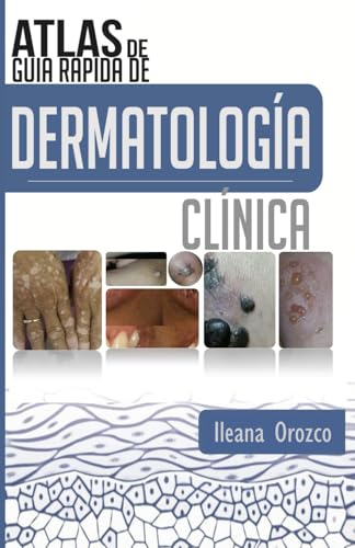 Atlas de Guía Rápida de Dermatología Clínica Atlas de Guía Rápida de Dermatología Clínica von Independiente