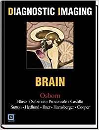 Diagnostic Imaging - Brain: Top 250 Diagnostic Diagnostic Imaging - Brain: Top 250 Diagnostic