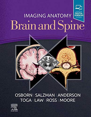 Imaging Anatomy Brain and Spine Imaging Anatomy Brain and Spine von Elsevier
