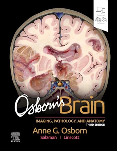 Osborn's Brain: Imaging, Pathology, and Anatomy von Elsevier