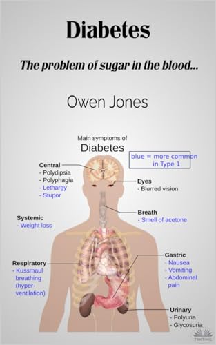 Diabetes: The Problem Of Sugar In The Blood... von Tektime