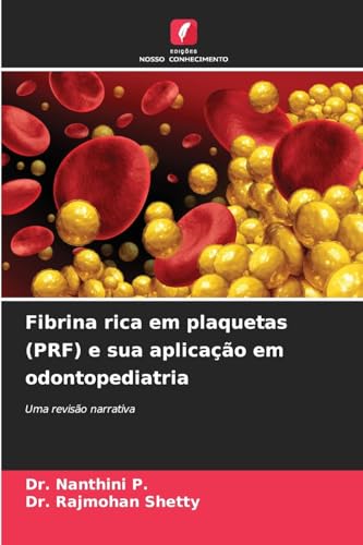 Fibrina rica em plaquetas (PRF) e sua aplicação em odontopediatria: Uma revisão narrativa von Edições Nosso Conhecimento