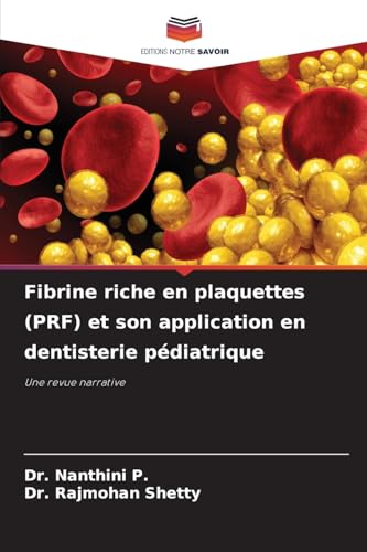 Fibrine riche en plaquettes (PRF) et son application en dentisterie pédiatrique: Une revue narrative von Editions Notre Savoir
