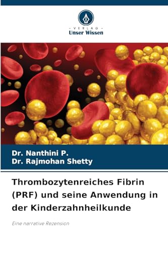 Thrombozytenreiches Fibrin (PRF) und seine Anwendung in der Kinderzahnheilkunde: Eine narrative Rezension von Verlag Unser Wissen