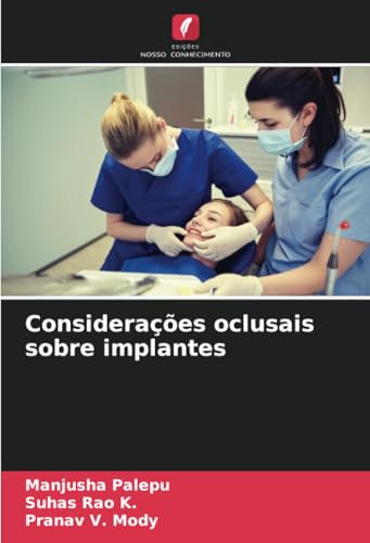 Considerações oclusais sobre implantes von Edições Nosso Conhecimento
