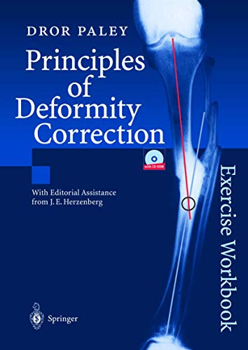 Principles of Deformity Correction: Exercise Workbook von Springer