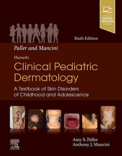 Paller and Mancini - Hurwitz Clinical Pediatric Dermatology: A Textbook of Skin Disorders of Childhood & Adolescence von Elsevier