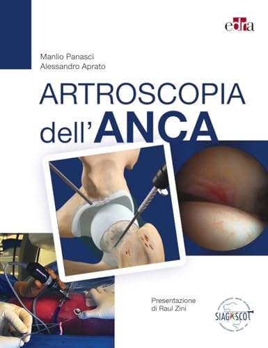 Artroscopia dell'anca Artroscopia dell'anca von Edra