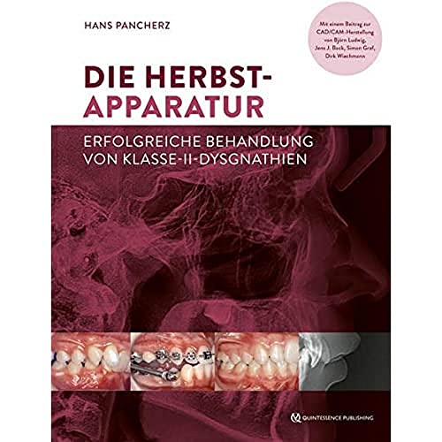 Die Herbst-Apparatur: Erfolgreiche Behandlung von Klasse-II-Dysgnathien von Quintessenz Verlag