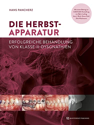 Die Herbst-Apparatur: Erfolgreiche Behandlung von Klasse-II-Dysgnathien von Quintessenz Verlag