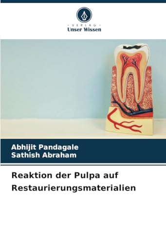 Reaktion der Pulpa auf Restaurierungsmaterialien von Verlag Unser Wissen