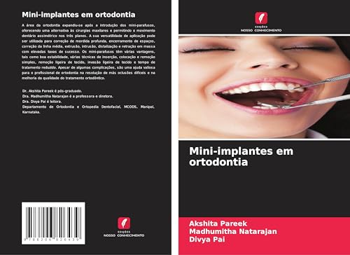 Mini-implantes em ortodontia: DE von Edições Nosso Conhecimento