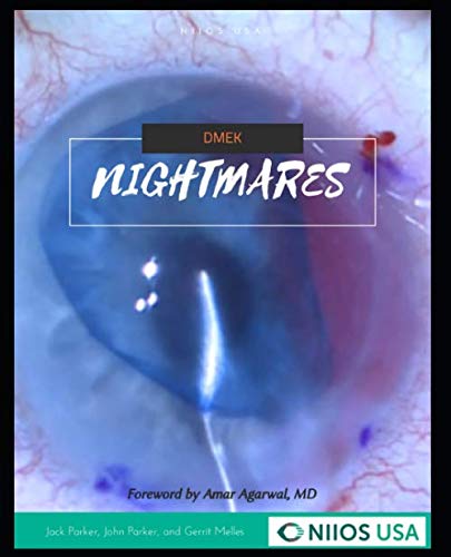 DMEK Nightmares von Independently published