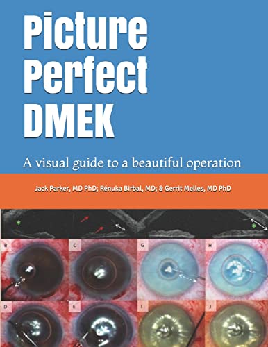 Picture Perfect DMEK: A visual guide to a beautiful operation