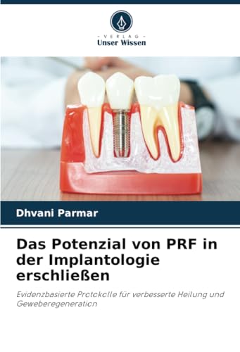 Das Potenzial von PRF in der Implantologie erschließen: Evidenzbasierte Protokolle für verbesserte Heilung und Geweberegeneration von Verlag Unser Wissen