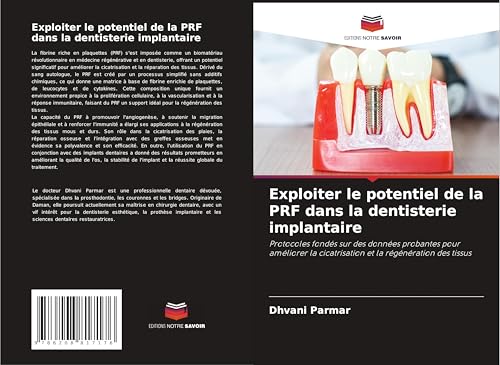 Exploiter le potentiel de la PRF dans la dentisterie implantaire: Protocoles fondés sur des données probantes pour améliorer la cicatrisation et la régénération des tissus von Editions Notre Savoir