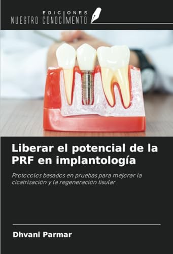 Liberar el potencial de la PRF en implantología: Protocolos basados en pruebas para mejorar la cicatrización y la regeneración tisular von Ediciones Nuestro Conocimiento