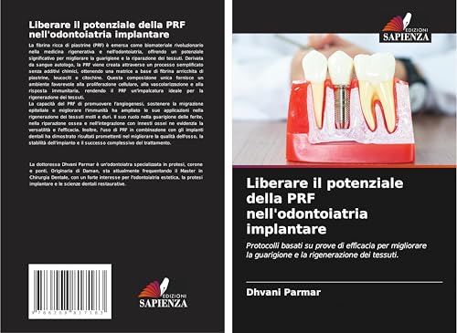 Liberare il potenziale della PRF nell'odontoiatria implantare: Protocolli basati su prove di efficacia per migliorare la guarigione e la rigenerazione dei tessuti. von Edizioni Sapienza