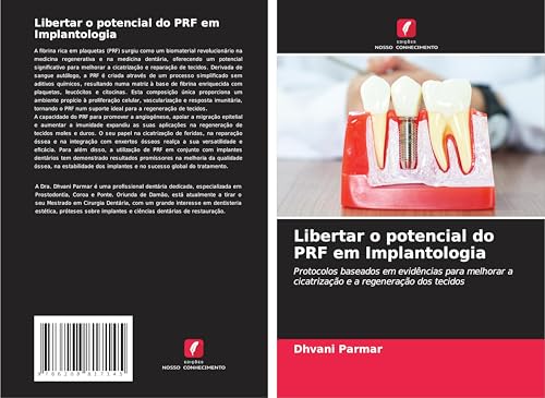 Libertar o potencial do PRF em Implantologia: Protocolos baseados em evidências para melhorar a cicatrização e a regeneração dos tecidos von Edições Nosso Conhecimento