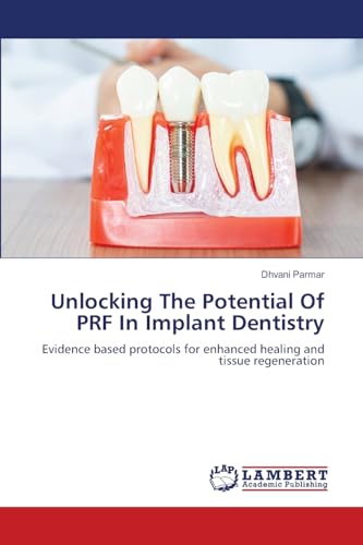 Unlocking The Potential Of PRF In Implant Dentistry: Evidence based protocols for enhanced healing and tissue regeneration von LAP LAMBERT Academic Publishing