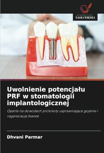 Uwolnienie potencjału PRF w stomatologii implantologicznej: Oparte na dowodach protokoły usprawniające gojenie i regenerację tkanek: Oparte na ... usprawniaj¿ce gojenie i regeneracj¿ tkanek von Wydawnictwo Nasza Wiedza
