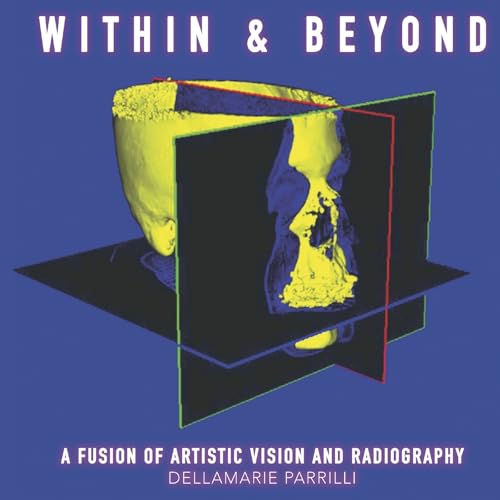 Within & Beyond: A Fusion of Artistic Vision and Radiography von Bookbaby