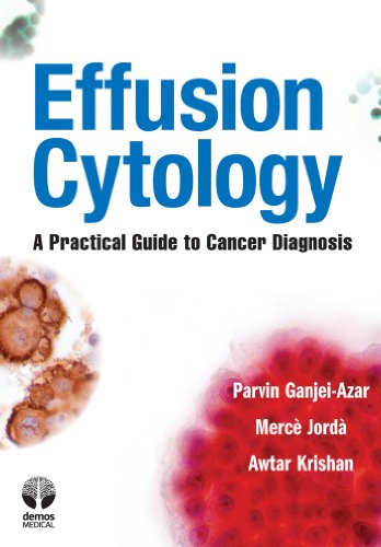 Effusion Cytology: A Practical Guide to Cancer Diagnosis von Transatlantic Publishers