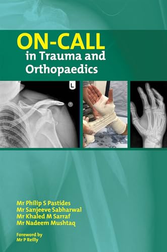 On-Call in Trauma and Orthopaedics von Libri Publishing Ltd