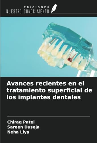 Avances recientes en el tratamiento superficial de los implantes dentales von Ediciones Nuestro Conocimiento