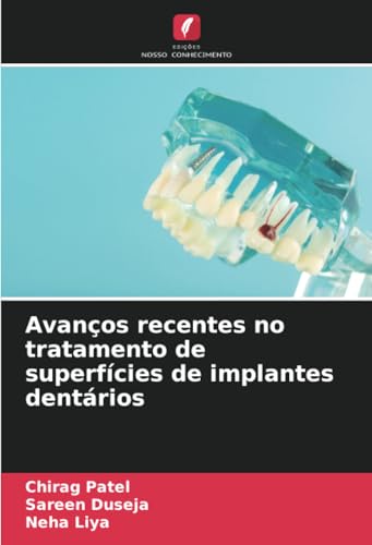 Avanços recentes no tratamento de superfícies de implantes dentários von Edições Nosso Conhecimento